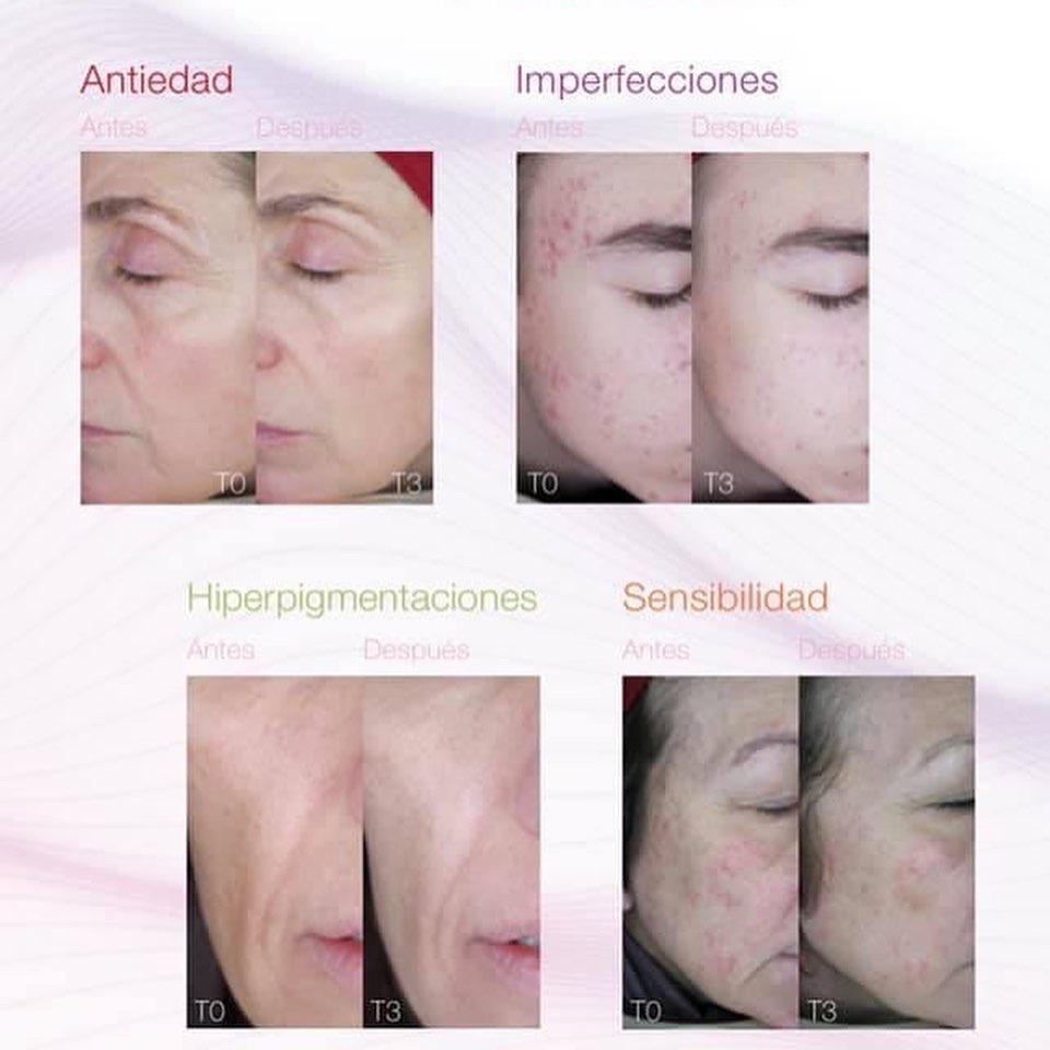 Resultados reales — antes y después